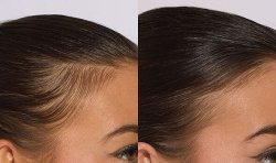 Thin-haired shoppers see 'less hair loss' in two weeks with Caudalie's new scalp serum