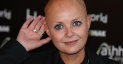 Gail Porter left with horror injuries after falling down flight of stairs