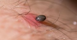 Horror as woman spends '6 weeks in coma' after tick bite on holiday in Europe